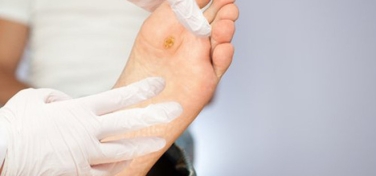 4 dấu hiệu bất thường ở chân nên “dừng lại” để kiểm tra sức khỏe