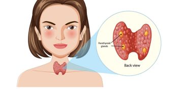 NHÂN TUYẾN GIÁP 12MM CÓ THỂ BỊ UNG THƯ KHÔNG? ĐIỀU TRỊ NHƯ THẾ NÀO?