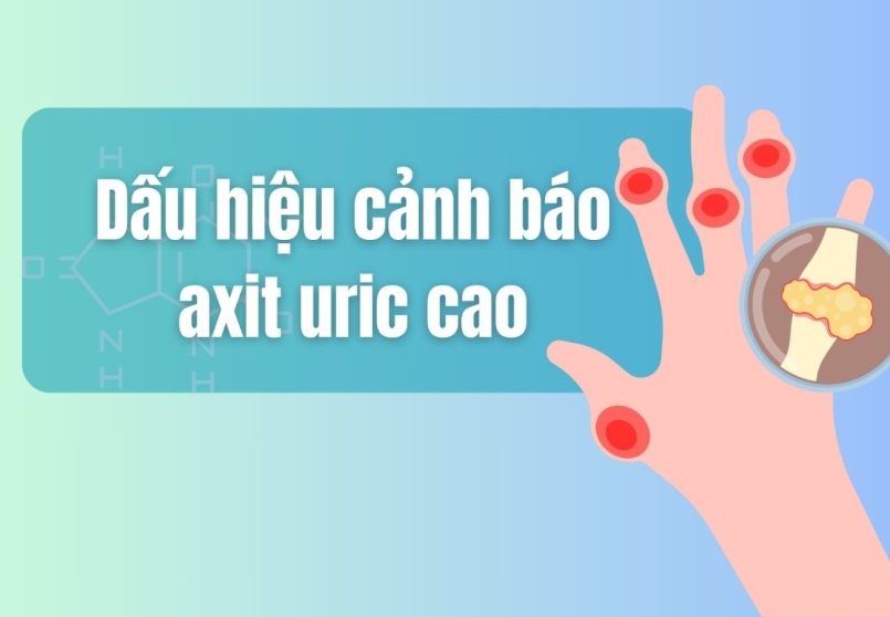 6 dấu hiệu cảnh báo axit uric tăng